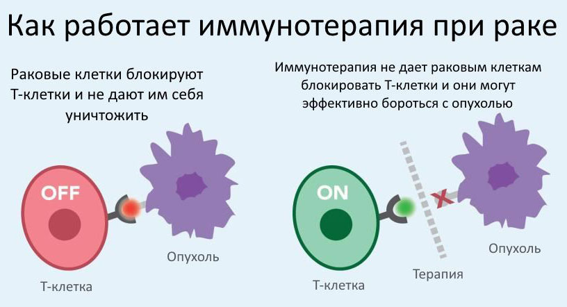 Иммунотерапия