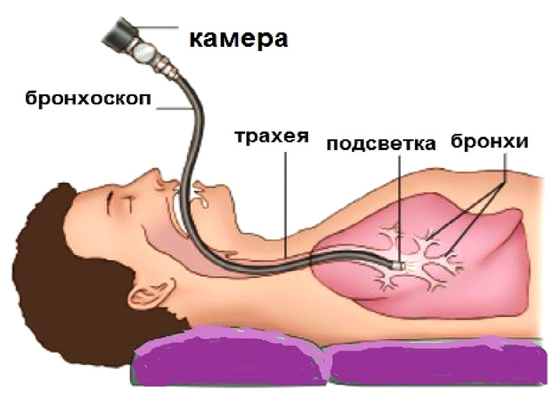 Эндоскопическая диагностика